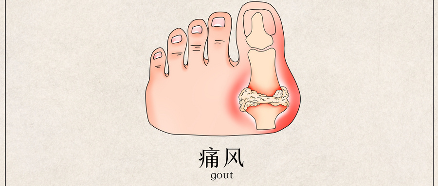 攝圖網(wǎng)_401790423_wx_痛風(fēng)醫(yī)療插畫（非企業(yè)商用）.jpg